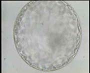 Magnified Expanded Blastocyst with clear Inner Cell Mass