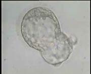 Magnified Hatching Blastocyst