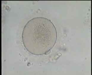 Mature Oocyte showing the 1st polar body and Cytoplasmic Granulation