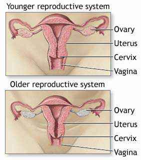 Menopause