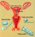 Points discussed before using any contraceptive method
