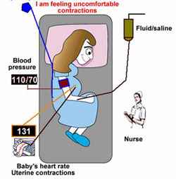 Prerequisites for epidural