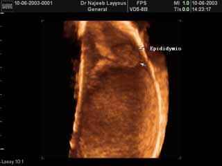 Epididymis 3D