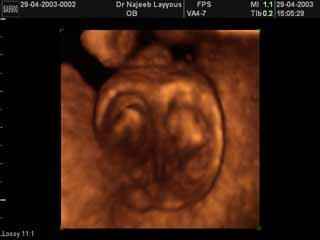 Fetal Scrotal Ultrasound