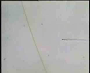 sperm entering the needle