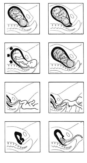 stages of labour