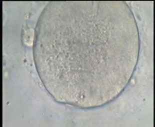 The location of the injected sperm in the Oocyte after ICSI