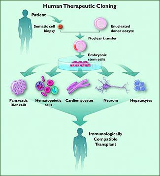 Therapeutic cloning