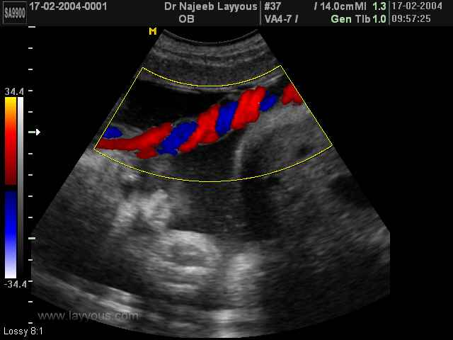 umbilical cord