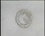 Blastocyst avec le différent fait de classer