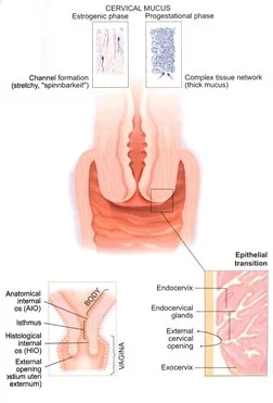 causes-cervicales-d'infertilité-dans-les-femmes
