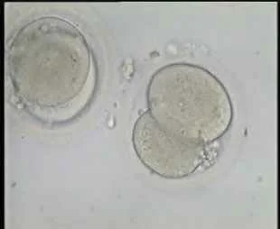 4-cell embryos