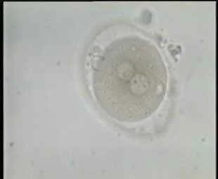 A fertilized egg non natural