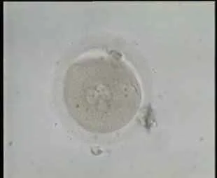 Two Gametes with clear Fertilization