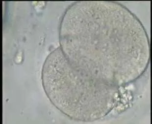 Embryos Bouklitin