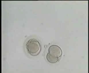 Embryo Bouklitin enlarged
