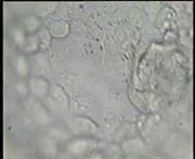 Masse de Cellule Intérieure de Blastocyst