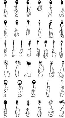 normal-and-abnormal-sperm