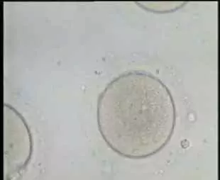 oocyte-non-mûr-avec-la-vésicule-germinale