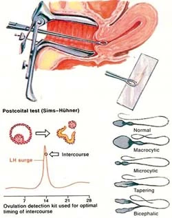 postez-l'épreuve-de-coital