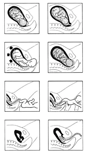 stages of labour