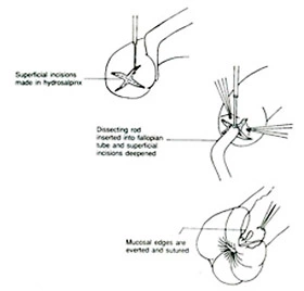 traitement-chirurgical-pour-l'infertilité-femelle