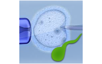 Intracytoplasmic Morphologically Selected Sperm Injection - IMSI. Recent IVF technology  and how it improves ICSI results
