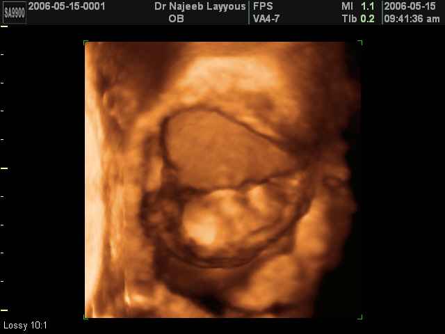 Fetal Liver