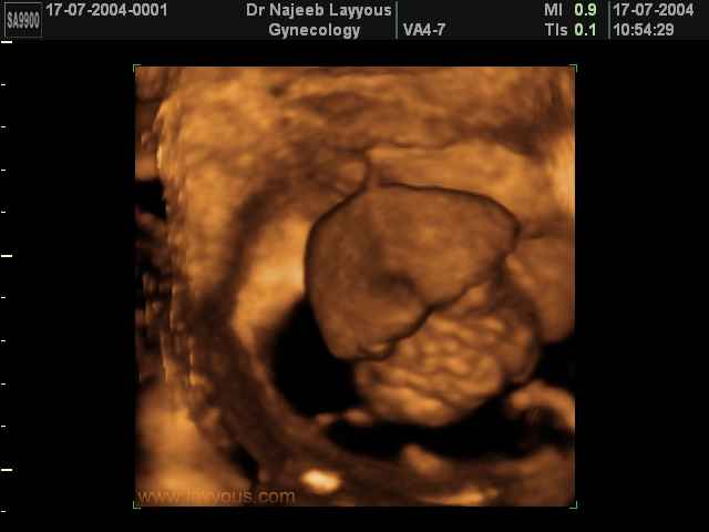 Fetal liver