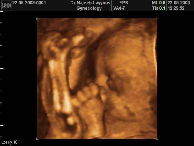 profile du fœtus