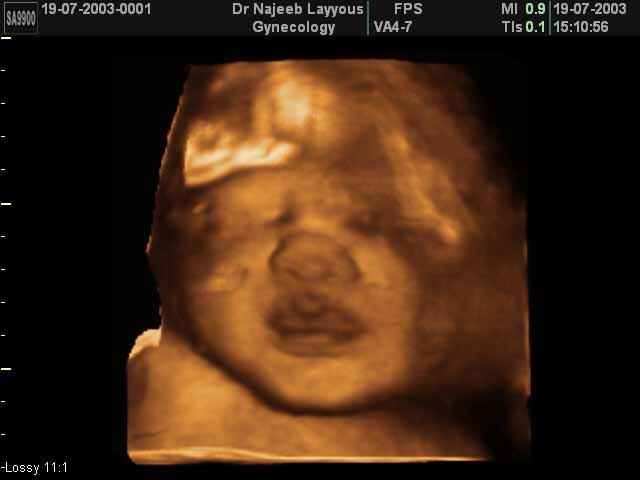 fetal face