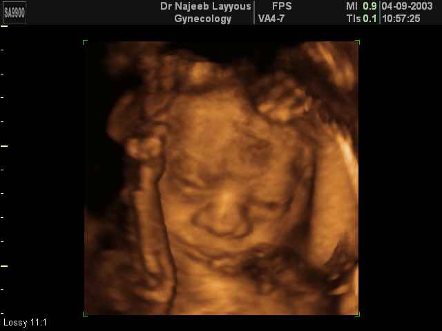 صورة وجه الجنين