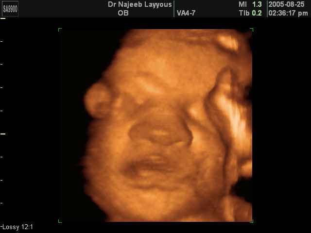 fetal face