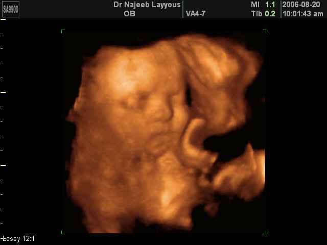 fetal face